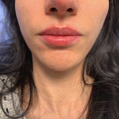 Lips